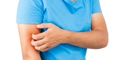 Kaşıntı Neden Olur? Kaşıntıya İyi Gelen Kremler Nelerdir?