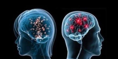 Beyinde Küçülmeye neden olur...