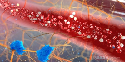 Damar Tıkanıklığına Doğal Çözüm