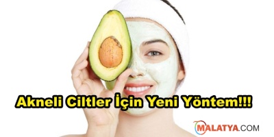 Sivilceler İçin Avokado Maskesi