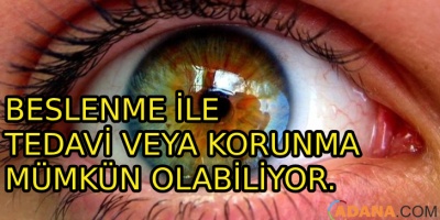 Sarı Nokta Hastalığı