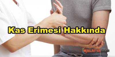 Kas Erimesi Hakkında Bilinmesi Gereken Her şey