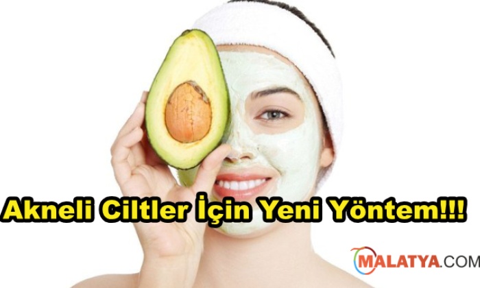 Sivilceler İçin Avokado Maskesi