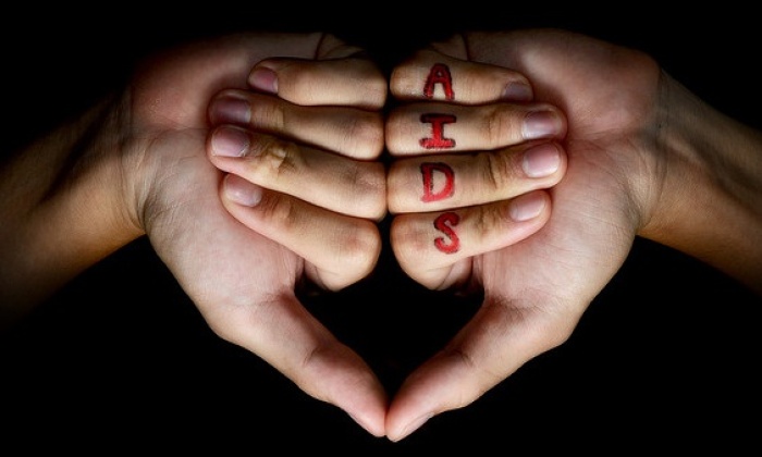 AIDS nedir? AIDS belirtiler nelerdir?
