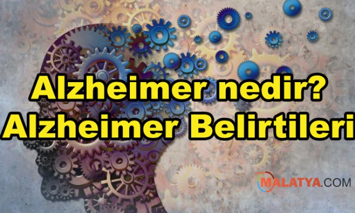 Alzheimer nedir? Alzheimer Belirtileri
