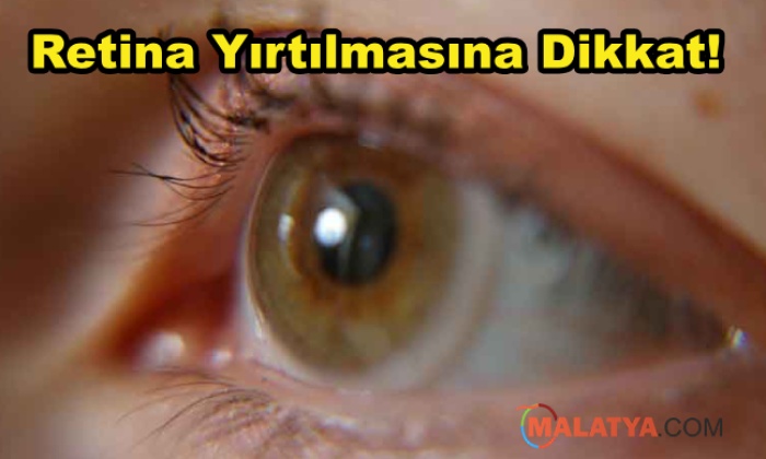 Dikkat! Retina Yırtığı Kör Edebilir