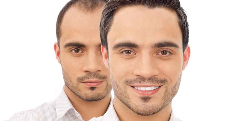 Saç dökülmesine karşı muhteşem etki sağlayan losyon