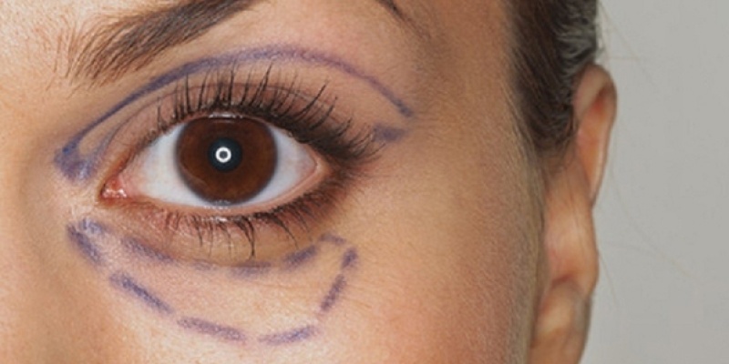 Göz torbası deyip geçmeyin