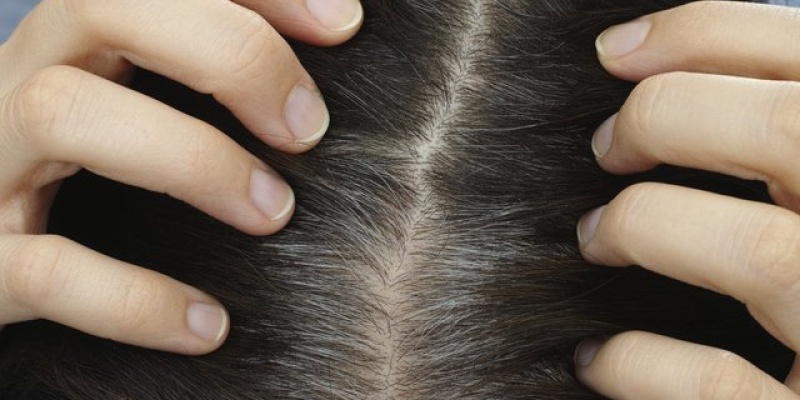 Saçta Egzama Tedavileri