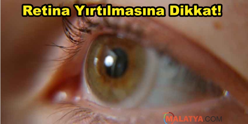 Dikkat! Retina Yırtığı Kör Edebilir