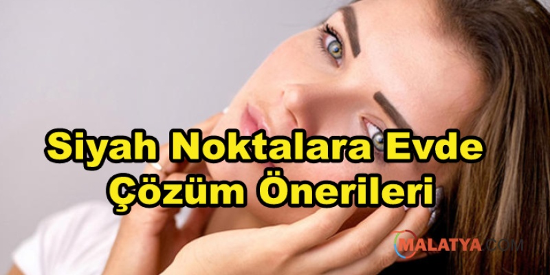 Siyah Noktalara Evde Çözüm Önerileri